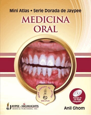 Anil Ghom - Mini Atlas Serie Dorada de Jaypee: Medicina Oral, Inbunden. Tillgänglighet: Tillfälligt slut