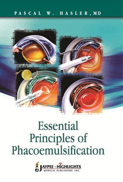 Pascal W Hasler - Essential Principles of Phacoemulsification, Inbunden