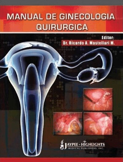 Ricardo A Mastellari M - Manual de Ginecología Quirúrgica, Inbunden. Tillgänglighet: Tillfälligt slut