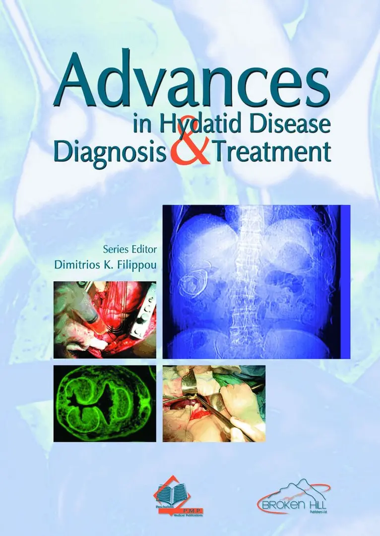 Dimitrios K. Philippou - Advances in Hydatid Disease, Häftad. Tillgänglighet: Tillfälligt slut