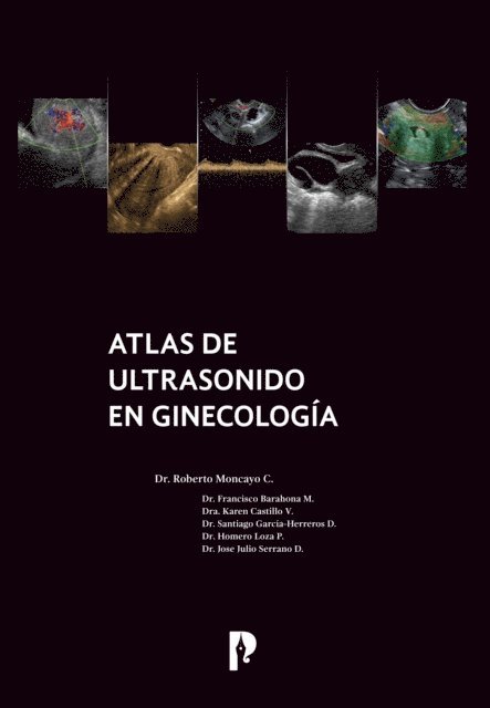 Jose Julio Serrano, Homero Loza, Santiago Garcia-Herreros, Karen Castillo, Francisco Barahona, Roberto Moncayo - Atlas de ultrasonido en ginecología, E-bok