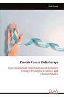 Nada Samir - Prostate Cancer Radiotherapy, Häftad