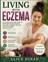 Alice Dinan - Living With Eczema, Häftad. Tillgänglighet: Tillfälligt slut