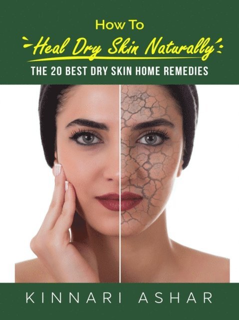 Kinnari Ashar - How to Heal Dry Skin Naturally, E-bok