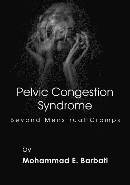 Mohammad E. Barbati - Pelvic Congestion Syndrome - Beyond Menstrual Cramps, E-bok