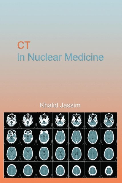 Khalid Jassim - CT in Nuclear Medicine, E-bok. Tillgänglighet: Lägg i varukorg