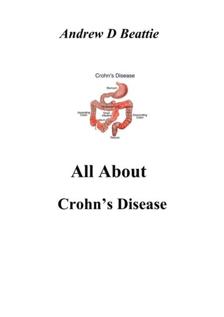 Andrew D Beattie - All About Crohn's Disease, E-bok