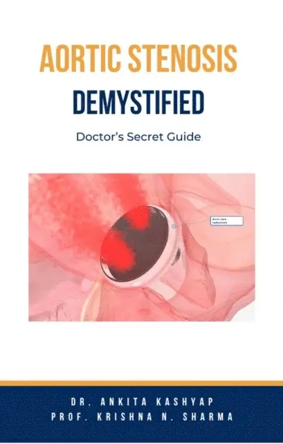 Prof. Krishna N. Sharma, Dr. Ankita Kashyap - Aortic Stenosis Demystified: Doctor's Secret Guide, E-bok. Tillgänglighet: Lägg i varukorg