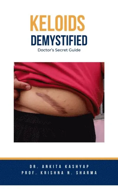 Prof. Krishna N. Sharma, Dr. Ankita Kashyap - Keloids Demystified: Doctor's Secret Guide, E-bok. Tillgänglighet: Lägg i varukorg