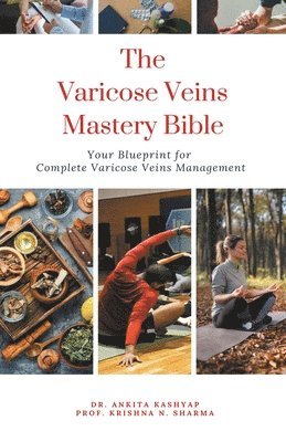 Ankita Kashyap, Prof Krishna N Sharma - Varicose Veins Mastery Bible, Häftad