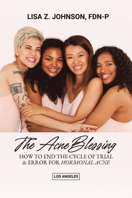 Lisa Johnson - Acne Blessing, E-bok