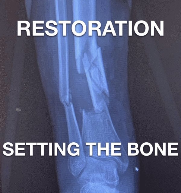 Joshua Rhoades - Restoration - Setting The Bone, E-bok