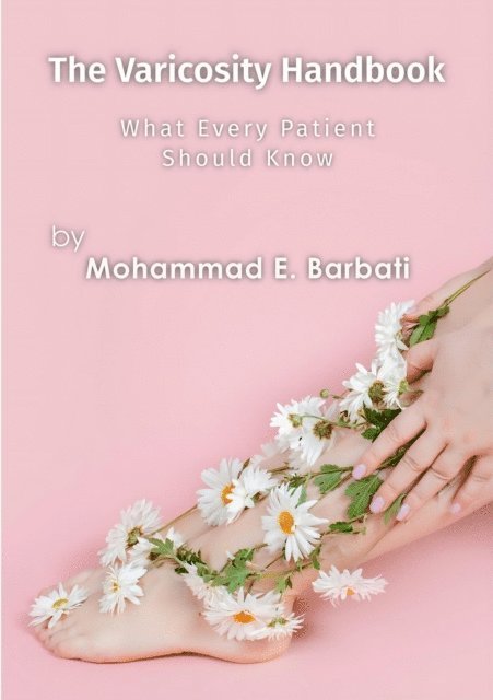 Mohammad E. Barbati - Varicosity Handbook - What Every Patient Should Know, E-bok