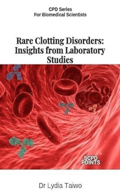 Dr Lydia Taiwo - Rare Clotting Disorders: Insights from Laboratory Studies, E-bok. Tillgänglighet: Lägg i varukorg