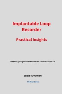 Implantable Loop Recorder: Practical Insights