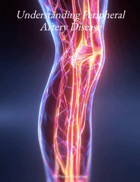 Pejman Hajbabaie - Understanding Peripheral Artery Disease, E-bok. Tillgänglighet: Lägg i varukorg