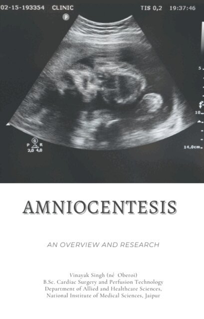 Vinayak Singh Oberoi - Amniocentesis: An Overview and Research, E-bok