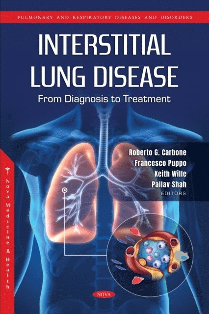 Roberto G. Carbone - Interstitial Lung Disease: From Diagnosis to Treatment, E-bok