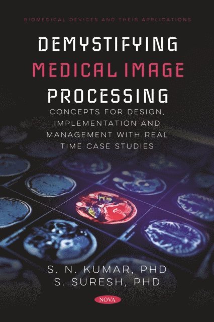 S N Kumar - Demystifying Medical Image Processing Concepts for Design, Implementation and Management with Real Time Case Studies, E-bok