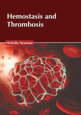 Nicholle Newman - Hemostasis and Thrombosis, Inbunden. Tillgänglighet: Lägg i varukorg