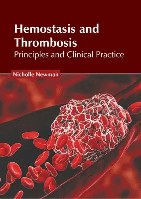 Nicholle Newman - Hemostasis and Thrombosis: Principles and Clinical Practice, Inbunden. Tillgänglighet: Lägg i varukorg