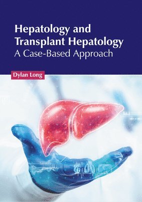 Dylan Long - Hepatology and Transplant Hepatology: A Case-Based Approach, Inbunden. Tillgänglighet: Lägg i varukorg
