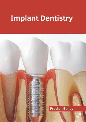 Preston Bailey - Implant Dentistry, Inbunden. Tillgänglighet: Lägg i varukorg