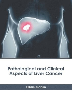 Eddie Goblin - Pathological and Clinical Aspects of Liver Cancer, Inbunden. Tillgänglighet: Lägg i varukorg