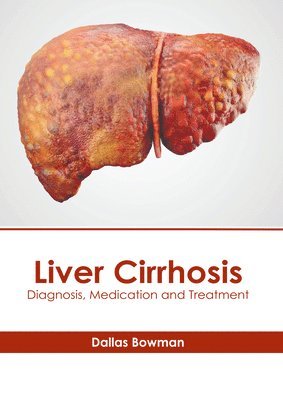 Dallas Bowman - Liver Cirrhosis: Diagnosis, Medication and Treatment, Inbunden. Tillgänglighet: Lägg i varukorg