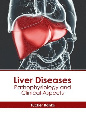 Tucker Banks - Liver Diseases: Pathophysiology and Clinical Aspects, Inbunden. Tillgänglighet: Lägg i varukorg