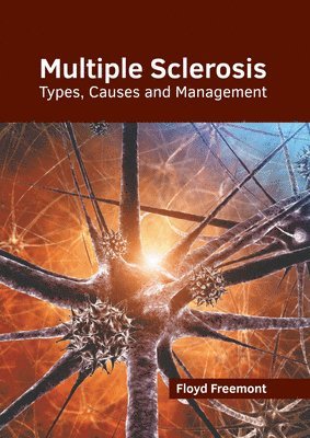 Floyd Freemont - Multiple Sclerosis: Types, Causes and Management, Inbunden