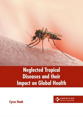 Cyrus Hank - Neglected Tropical Diseases and Their Impact on Global Health, Inbunden. Tillgänglighet: Lägg i varukorg