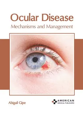 Abigail Gipe - Ocular Disease: Mechanisms and Management, Inbunden. Tillgänglighet: Lägg i varukorg