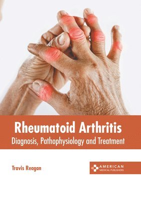 Travis Reagan - Rheumatoid Arthritis: Diagnosis, Pathophysiology and Treatment, Inbunden. Tillgänglighet: Lägg i varukorg