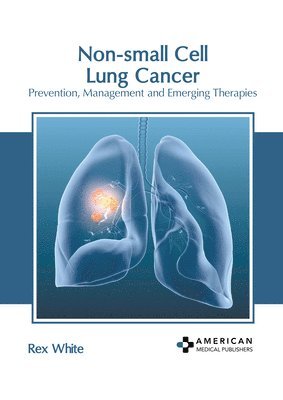 Rex White - Non-Small Cell Lung Cancer: Prevention, Management and Emerging Therapies, Inbunden. Tillgänglighet: Lägg i varukorg