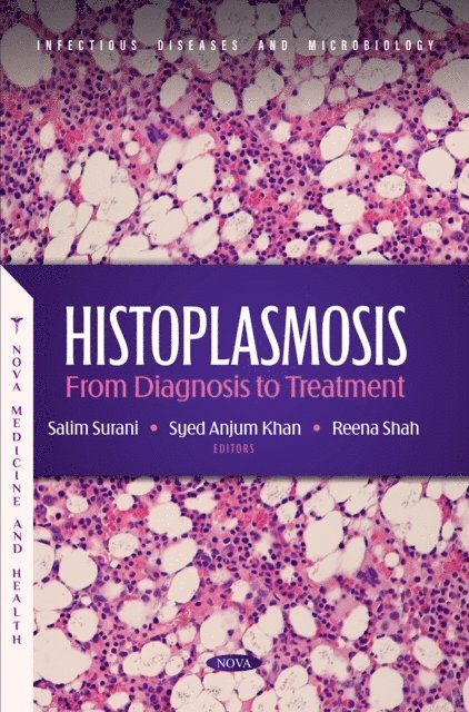 Salim Surani - Histoplasmosis: From Diagnosis to Treatment, E-bok. Tillgänglighet: Lägg i varukorg