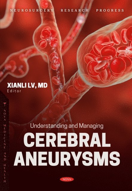 Xianli Lv - Understanding and Managing Cerebral Aneurysms, E-bok