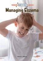 Muriel DuBois - Managing Eczema, Inbunden