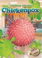 Chickenpox