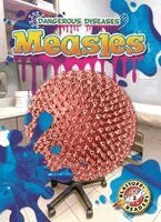 Measles