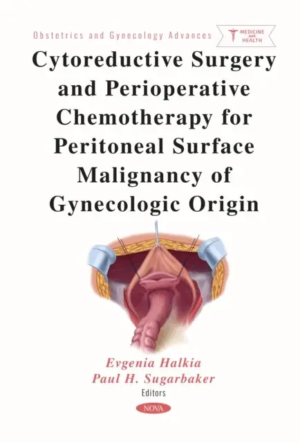 Evgenia Halkia - Cytoreductive Surgery and Perioperative Chemotherapy for Peritoneal Surface Malignancy of Gynecologic Origin, E-bok. Tillgänglighet: Lägg i varukorg