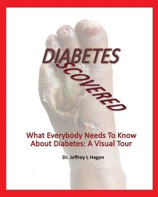 Diabetes Discovered